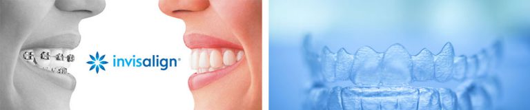 Invisalign In Commerce Township Mi Berkman And Shapiro Ortho