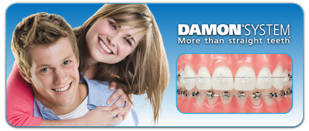 Damon Systems at Berkman & Shapiro Orthodontics, Commerce Township, MI 48382