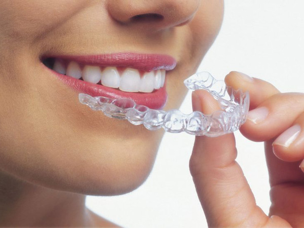 Invisalign Bensalem PA, Clear Braces