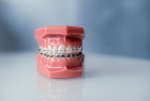 Getting Braces As An Adult The Treatment Options