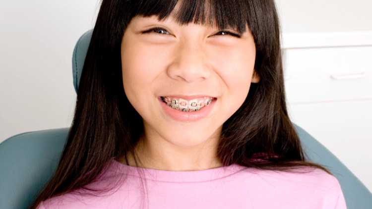 The Benefits Of Early Orthodontic Intervention For Children