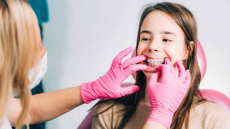 Braces Colors How To Choose The Perfect Shade To Personalize Your Smile