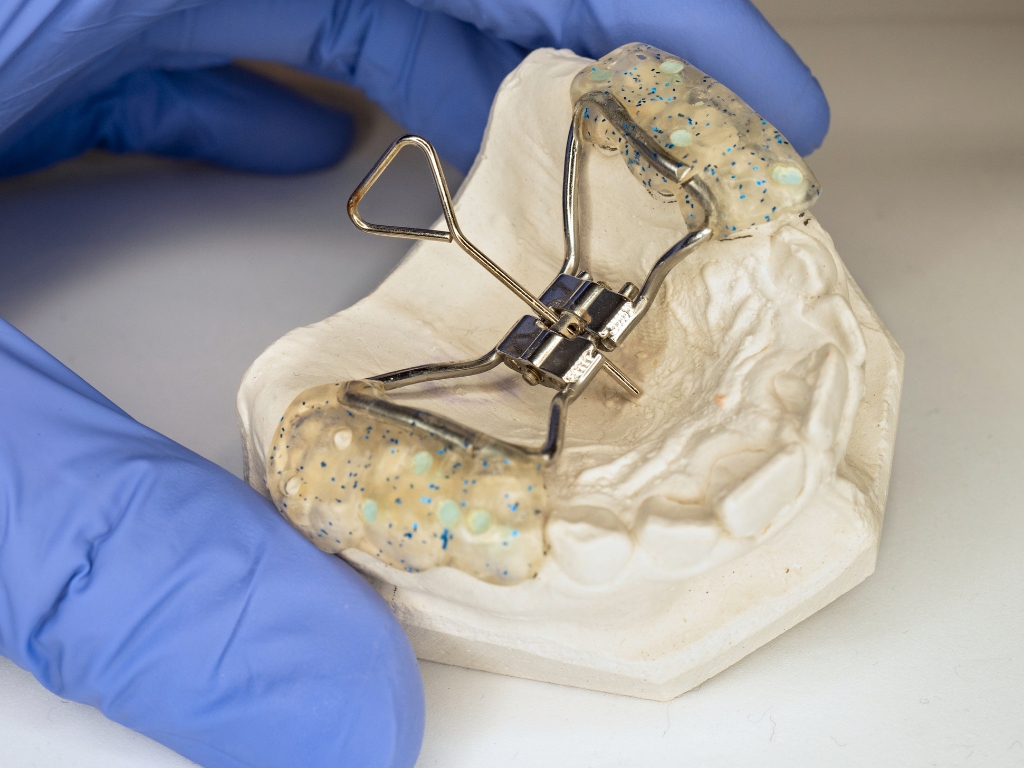 palate-expander