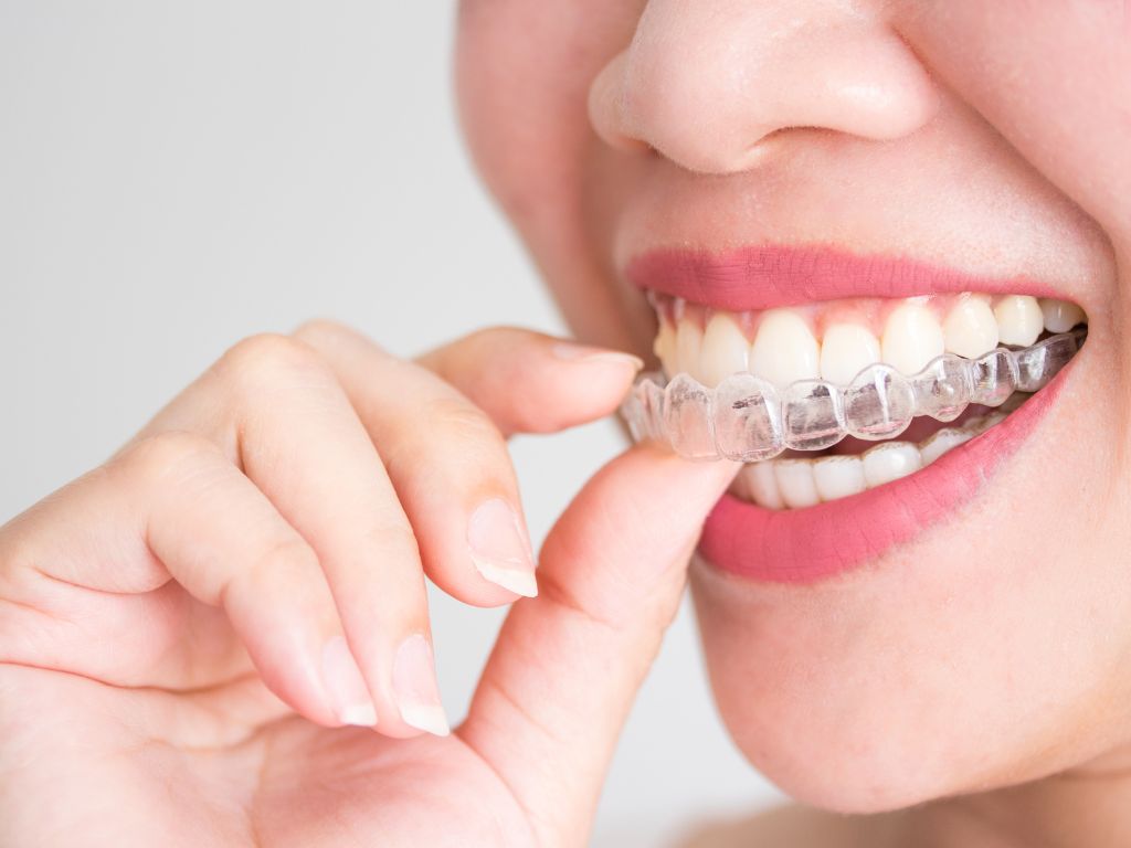 mouthguard-for-braces