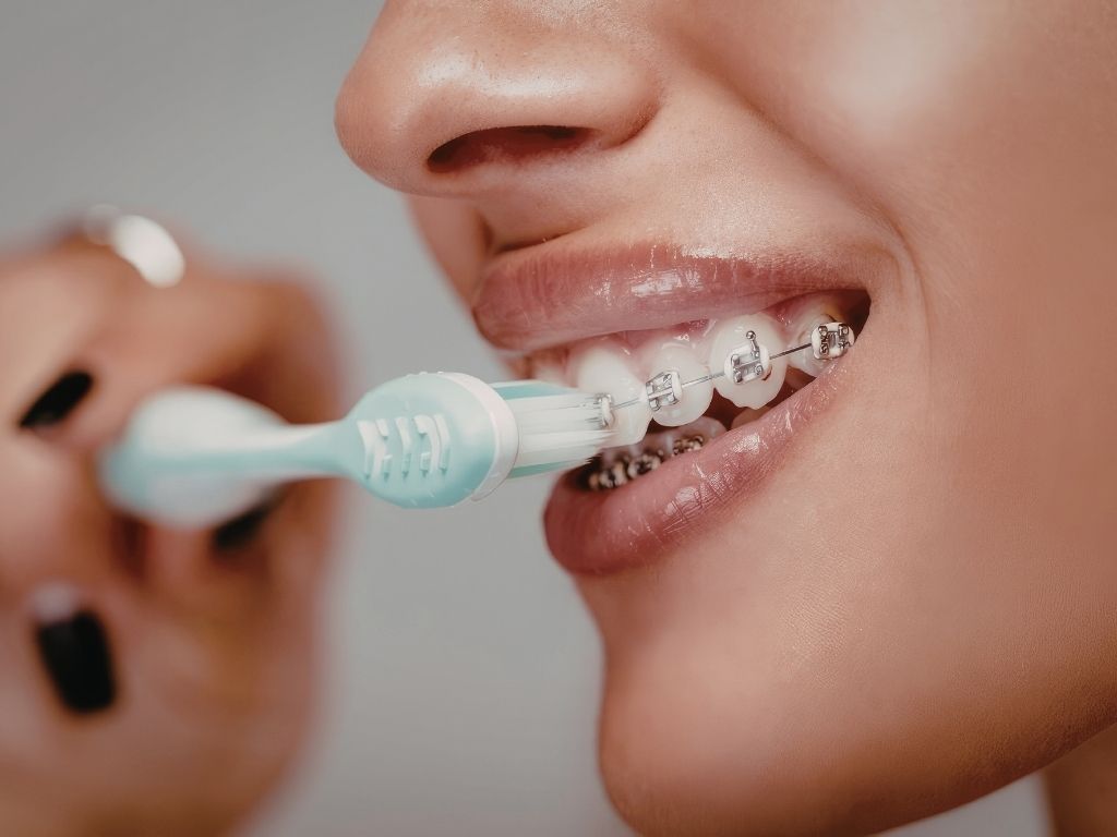 Patient brushing teeth with braces, illustrating the best toothpaste for braces and proper oral care during orthodontic treatment.